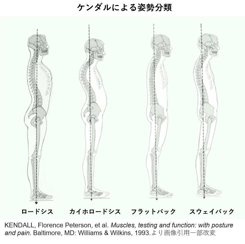 肩こり　腰痛　姿勢　