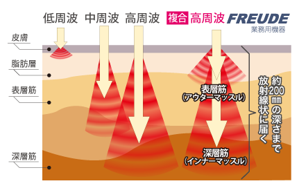 楽してダイエット Eトレ 高周波