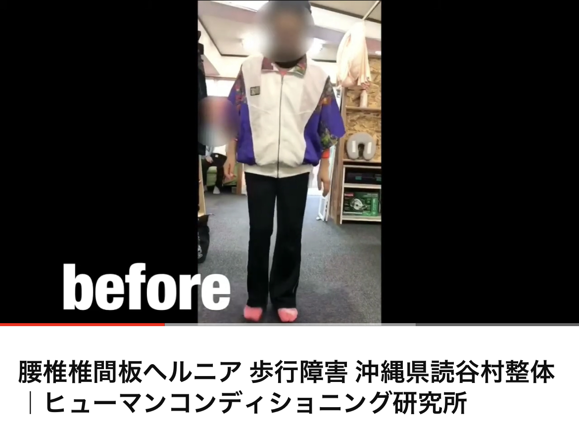 腰痛